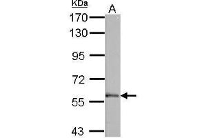 Western Blotting (WB) image for anti-Membrane Protein, Palmitoylated 6 (MAGUK P55 Subfamily Member 6) (MPP6) (N-Term) antibody (ABIN2856554)