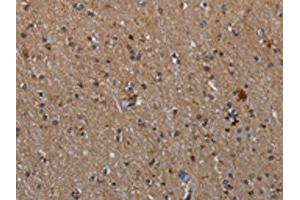 The image on the left is immunohistochemistry of paraffin-embedded Human brain tissue using ABIN7191485(MMP23B Antibody) at dilution 1/20, on the right is treated with synthetic peptide. (MMP23A antibody)