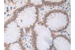 Immunohistochemistry (IHC) image for anti-Coagulation Factor II (Thrombin) Receptor-Like 3 (F2RL3) (AA 48-385) antibody (ABIN7431131)