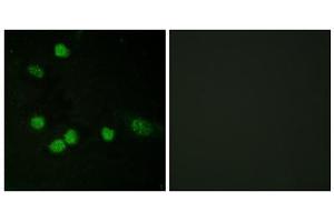 Immunofluorescence analysis of HeLa cells, using Raf1 (epitope around residue 621) antibody. (RAF1 antibody  (Ser621))