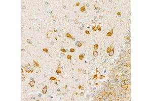 Immunohistochemistry of paraffin embedded rat substantia nigra using EFNB3 (ABIN7073845) at dilution of 1: 1200 (350x lens)