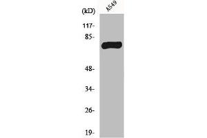 Western Blot analysis of A549 cells using MPP9 Polyclonal Antibody (MPHOSPH9 antibody  (C-Term))