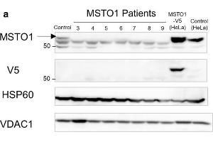 Pathogenic variants lead to MSTO1 protein instability. (MSTO1 antibody  (Center))