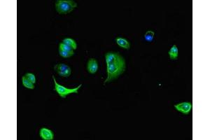 Immunofluorescent analysis of MCF-7 cells using ABIN7150890 at dilution of 1:100 and Alexa Fluor 488-congugated AffiniPure Goat Anti-Rabbit IgG(H+L)