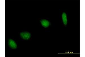 Immunofluorescence of purified MaxPab antibody to UBE2V1 on HeLa cell. (UBE2V1 antibody  (AA 1-147))