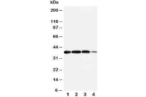 Western blot testing of Arg2 antibody and Lane 1:  rat lung;  2: (r) testis;  3: human A549;  4: (h) 293T cell lysate. (ARG2 antibody  (N-Term))