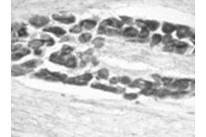 Immunohistochemical staining for BDNF in rat dorsal root ganglion (DRG) using BDNF polyclonal antibody  at an amount of 5 ug/mL . (BDNF antibody)