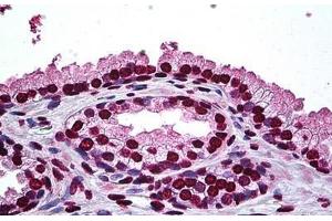 Human Prostate: Formalin-Fixed, Paraffin-Embedded (FFPE) (DLX2 antibody  (AA 1-110))