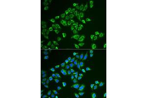 Immunofluorescence analysis of HeLa cells using TAC3 antibody. (Tachykinin 3 antibody  (AA 1-121))