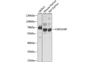 Western blot analysis of extracts of various cell lines, using CDKN2AIP antibody (ABIN1679162, ABIN3017622, ABIN3017623 and ABIN6220167) at 1:1000 dilution. (CDKN2AIP antibody  (AA 1-220))