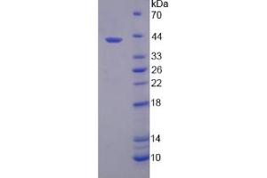 Image no. 1 for Solute Carrier Family 39 (Zinc Transporter), Member 6 (SLC39A6) (AA 29-325) protein (His tag) (ABIN6237349) (SLC39A6 Protein (AA 29-325) (His tag))