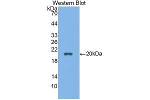 Detection of Recombinant CALY, Rat using Polyclonal Antibody to Calcyon Neuron Specific Vesicular Protein (CALY) (CALY antibody  (AA 110-226))