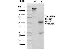 SDS-PAGE Analysis p57 Mouse Monoclonal Antibody (KIP2/880).
