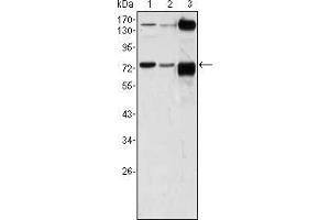 Western blot analysis using ATP2C1 mouse mAb against A431 (1), Hela (2) and HEK293 (3) cell lysate.
