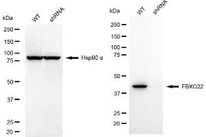 Western blotting analysis using FBXO22 antibody (ABIN7798556). (FBXO22 antibody)