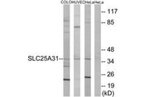 Western Blotting (WB) image for anti-Solute Carrier Family 25 (Mitochondrial Carrier, Adenine Nucleotide Translocator), Member 31 (SLC25A31) (AA 131-180) antibody (ABIN2890097) (SLC25A31 antibody  (AA 131-180))