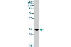 RAB33B monoclonal antibody (M01), clone 6F4.