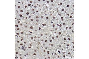 Immunohistochemistry of paraffin-embedded rat liver using PDCD7 Rabbit mAb (ABIN3022039, ABIN3022040, ABIN3022041, ABIN1513274 and ABIN1514421) at dilution of 1:100 (40x lens). (PDCD7 antibody)