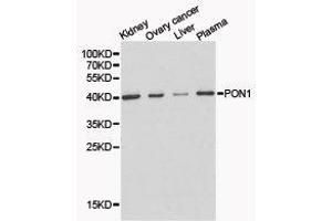 Western Blotting (WB) image for anti-Paraoxonase 1 (PON1) antibody (ABIN1874193) (PON1 antibody)