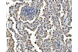 IHC analysis of FIP1L1 using anti-FIP1L1 antibody (ABIN7600761). (FIP1L1 antibody  (AA 23-558))