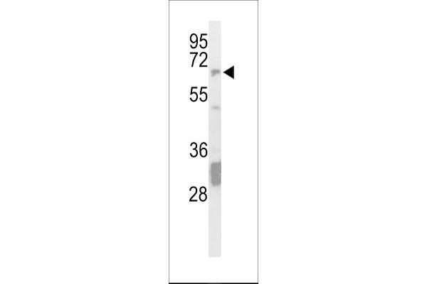 PTPN5 Antikörper  (N-Term)