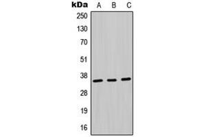 Western blot analysis of MDH1 expression in Jurkat (A), HepG2 (B), PC12 (C) whole cell lysates. (MDH1 antibody  (Center))