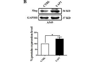 Slug is regulated by the co-transcriptional complex YAP1/TEAD in the EMT program of A549 cells. (GAPDH antibody)