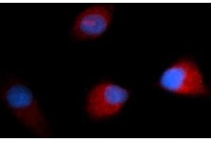 Immunofluorescence (IF) image for anti-Colony Stimulating Factor 1 (Macrophage) (CSF1) (AA 33-190) antibody (PE) (ABIN5568661) (M-CSF/CSF1 antibody  (AA 33-190) (PE))