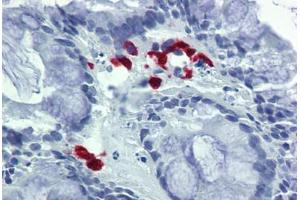 Human Colon: Formalin-Fixed, Paraffin-Embedded (FFPE) (FASL antibody  (AA 82-145))