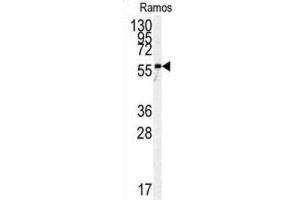 Pyruvate Kinase antibody