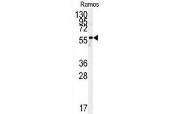 Pyruvate Kinase antibody