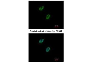 ICC/IF Image Immunofluorescence analysis of paraformaldehyde-fixed HeLa, using GABPB1, antibody at 1:500 dilution. (GABPB1 antibody  (Center))