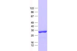 Validation with Western Blot (RAB3IP Protein (His tag))