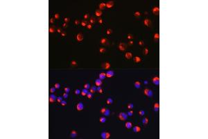 Immunofluorescence analysis of Neuro-2a cells using PRPH Rabbit pAb (ABIN1682318, ABIN3018463, ABIN3018464 and ABIN6220472) at dilution of 1:25 (40x lens). (Peripherin antibody  (AA 1-260))