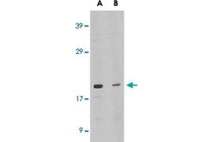 Western blot analysis of IL21 expression in HL-60 cell lysate in the absence (lane A) or presence of blocking peptide (lane B) with IL21 polyclonal antibody  at 1 ug /mL . (IL-21 antibody  (Internal Region))