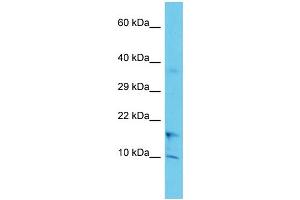 Host: Rabbit Target Name: COA1 Sample Type: Jurkat Whole Cell lysates Antibody Dilution: 1. (UBXN11 antibody  (C-Term))
