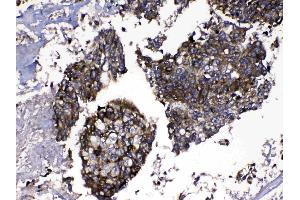IHC analysis of MMP16 using anti-MMP16 antibody . (MMP16 antibody  (AA 120-296))