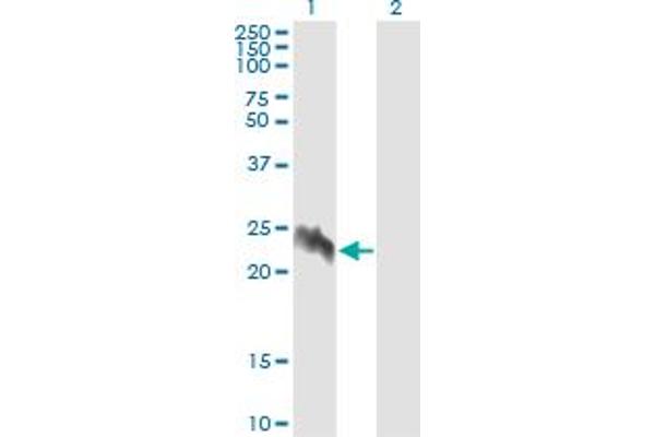 EIF5A2 antibody  (AA 66-153)