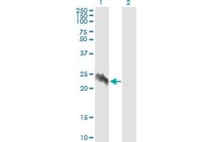 Western Blot analysis of EIF5A2 expression in transfected 293T cell line by EIF5A2 monoclonal antibody (M01), clone 1E7. (EIF5A2 antibody  (AA 66-153))