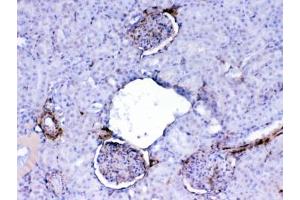 IHC testing of FFPE rat kidney tissue with Galectin 1 antibody at 1ug/ml. (LGALS1/Galectin 1 antibody)