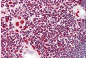 Anti-HnRNP K antibody IHC staining of human thymus. (HNRNPK antibody  (AA 200-250))