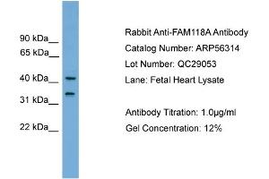 WB Suggested Anti-FAM118A  Antibody Titration: 0. (FAM118A antibody  (Middle Region))