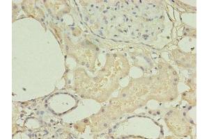 Immunohistochemistry of paraffin-embedded human kidney tissue using ABIN7155120 at dilution of 1:100 (HNRNPL antibody  (AA 89-335))