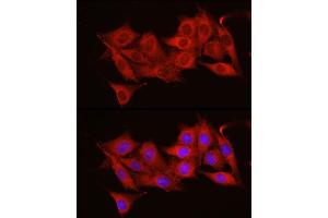 Immunofluorescence analysis of NIH/3T3 cells using  Rabbit pAb (ABIN6131155, ABIN6136539, ABIN6136540 and ABIN6221035) at dilution of 1:50 (40x lens). (ADAM9 antibody  (AA 475-685))