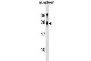 Western Blotting (WB) image for anti-Tumor Suppressor Candidate 1 (TUSC1) antibody (ABIN3000856) (TUSC1 antibody)
