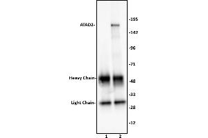 ATAD2 antibody (pAb) tested by Immunoprecipitation.