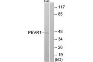 Western blot analysis of extracts from A549 cells, using PEVR1 Antibody. (PEVR1 (AA 43-92) antibody)