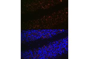 Immunofluorescence analysis of rat brain using SLC17 Rabbit pAb (ABIN7270407) at dilution of 1:100 (40x lens). (Solute Carrier Family 17 (Vesicular Glutamate Transporter), Member 6 (SLC17A6) (C-Term) antibody)