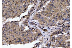 IHC analysis of GOLGA3 using anti-GOLGA3 antibody (ABIN7600298). (Golgin A3 antibody  (AA 176-1436))