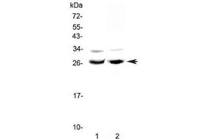 Western blot testing of 1) rat testis and 2) mouse ovary lysate with MAD antibody at 0. (MXD1 antibody)